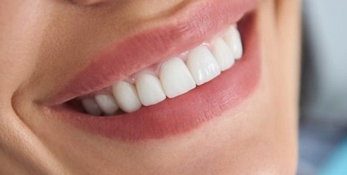 مراحل کامپوزیت دندان چگونه است