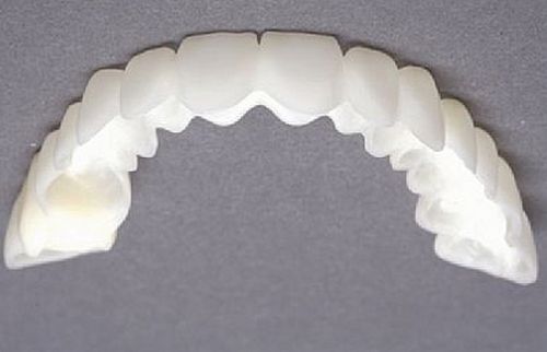 لمینت متحرک در دندانپزشکی چگونه ساخته میشود 