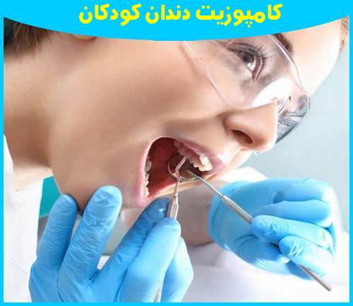 کامپوزیت دندان برای کودکان نوجوانان 